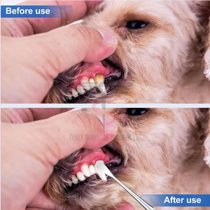 Kits Profesionales de Limpieza Dental de Acero Inoxidable con Empuñadura Ergonómica, Diseño Ligero y Reutilizable para un Fácil Uso en Clínicas - Product Image 3