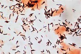 Probiotiques Lactobacillus Acidophilus de la marque IGC, origine Maharashtra - Product Image 3