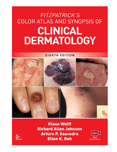 Atlas de Color de Fitzpatrick y Resumen de Dermatología Clínica, Octava Edición (Suministro al por Mayor) - Product Image 3