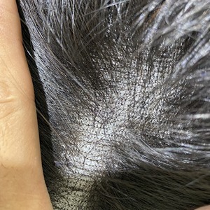 Extensiones de cabello humano indio sin procesar, mechones de pelo de trama 13x4 13x6, con encaje Frontal HD suizo, cutícula sin procesar, precio barato a la venta - Product Image 5