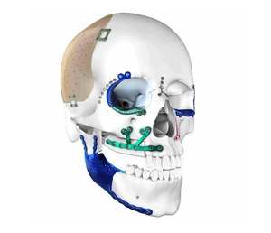 Modelo de Cráneo Muscular Desmontable de Acero Inoxidable 1:1, Herramienta de Enseñanza de Anatomía, con Instrucciones en Cinta Adhesiva, Alta Calidad, Tamaño y Color Personalizables - Product Image 1