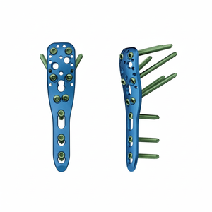 Plaques de blocage de sécurité pour humérus proximal de 3,5 mm, approuvées CE, les meilleures implants orthopédiques (2 pièces) avec 40 vis de blocage - Product Image 3