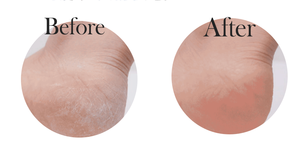 Crema Exfoliante Mineral para Pies OBM, Humectante y Removedora de Callosidades para Adultos, Hecha en Corea - Product Image 1