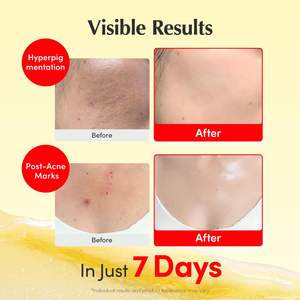 Crema Iluminadora con Vitaminas EQQUALBERRY, Vitamina C y 5% de Niacinamida + 3% de TXA, Humectante y Antienvejecimiento, Blanqueadora - Product Image 4