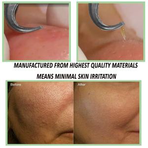 Stainless Steel Pimple Remover Blackhead <b>Extractor</b> Tweezers - Product Image 4