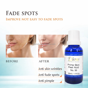 50% <b>Prime</b> Skin Peel Acid Witch Hazel Whitening Exfoliator Liquid Serum for Face & Body Anti-Aging Dark Spot Renewal 30mL - Product Image 4