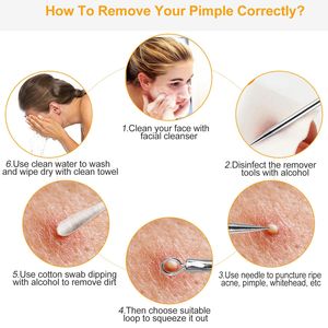 7-Piece <b>Blackhead</b> Acne <b>Extractor</b> Kit Stainless Steel Pimple & Needle Tools <b>Blackhead</b> Remover - Product Image 6