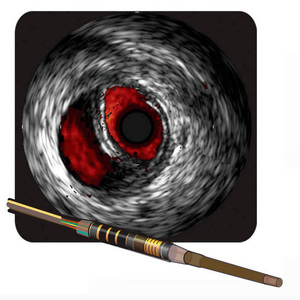 Catéter Avanzado de Grado Industrial VOLCANO VISIONS PV .014P RX Digital IVUS de 150 cm para Procedimientos de Imagenología de Arterias Periféricas - Product Image 4