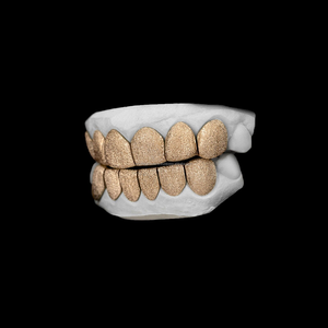 Dientes de metal dorados y plateados atractivos al por mayor Grillz con diamante tachonado con moissanita VVS chapado en oro para bodas y regalos - Product Image 2