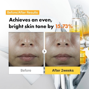 [APOTHE] เอ็กโซ ซัม เมลา-กลู ดาร์ก สปอต ไวท์เทนนิ่ง แอมพูล 30 มล. เซรั่มบำรุงผิวหน้า ผสมไฮยาลูรอนิค แอซิด ช่วยเติมความชุ่มชื้นและฟื้นฟูผิว - Product Image 2