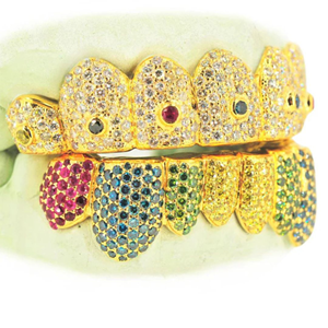Grillz dentaire Hip Hop personnalisé en argent sterling plaqué or, serti de moissanite, de luxe, écologique, cadeau de mariage et de fiançailles, bijoux corporels - Product Image 4