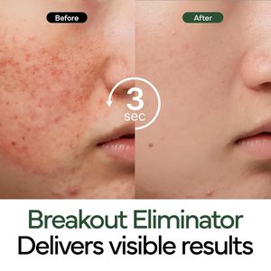 IVOSKIN Cica Centella Peptide Panthénol Acide Hyaluronique Crème de Nuit Anti-Acné Soin Hydratant Intensif Anti-Rougeurs Nourrissant - Product Image 6