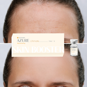 เจลบำรุงผิวหน้าและลำคอ ASCENART Azure EGF ไนอะซินาไมด์ ไฮยาลูรอนิค แอซิด ช่วยเพิ่มความชุ่มชื้น ยืดหยุ่น และบำรุงผิวอย่างอ่อนโยนทุกวัน - Product Image 2