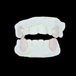 Grillz en argent sterling plaqué or avec diamants Moissanite taille brillant, micro-incrustation, unisexe, style Hip Hop, crocs de vampire, pour boîte de nuit - Product Image 2