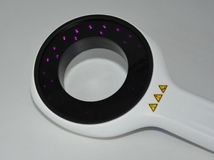 KN--9000C Portable Wood's Lamp Skin Analyzer UVA Dermatology Diagnostic Device - Product Image 4