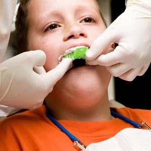 Juego Profesional de 12 Bandejas de Impresión Dental de Plástico Autoclavables, Perforadas, Reutilizables y Rígidas # 1 Parte Superior Grande - Verde - Product Image 4