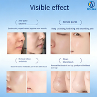 Appareil professionnel 3 en 1 de mésothérapie Dermashine Pro 4ème génération pour le raffermissement de la peau, anti-âge, hydratant, 9 aiguilles, étanche, prise US
