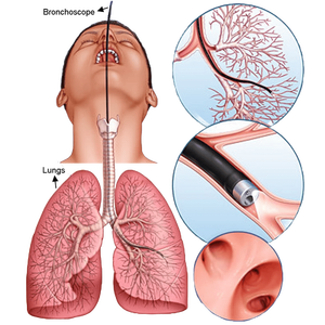 Endoskopi video anestesi portabel paling layak Video laringoskop bronchoskop video fleksibel nasophadoskop - Product Image 6