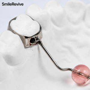 <span class=keywords><strong>Appareil</strong></span> orthodontique personnalisé <span class=keywords><strong>pour</strong></span> la correction des habitudes de succion, <span class=keywords><strong>pour</strong></span> l'arcade supérieure avec bandes molaires, appareils dentaires en gros <span class=keywords><strong>pour</strong></span> les cliniques - Product Image 4