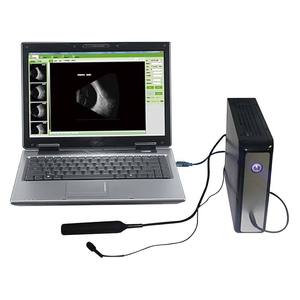 Escáner Oftálmico A/B de Bajo <span class=keywords><strong>Precio</strong></span> en China para Examen Oftalmológico y Prueba de Biometría Ocular en Oftalmología - Product Image 1