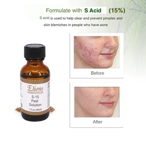 15% S acide Peeling sérum visage Anti-acné pores rétrécissement revitalisant Anti-âge tête noire dissolvant blanchissant corps utilisation - Product Image 3