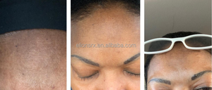 Elions Cosmeceuticals OEM 30% Prime Skin Peel Serum para Eliminar Cicatrices y Estrías, Blanqueamiento para Personas de Piel Oscura, Uso Profesional, Peeling - Product Image 5