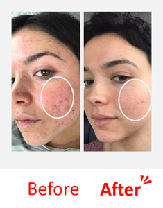 VELATOX Collagen Nano Liposome Vitamin C Anti-Wrinkle Firming Brightening Hydrating Skin Repair Elasticity <b>Face</b> Serum Korean - Product Image 3