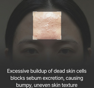 ดร.ดีพ เท็กซ์เจอร์ เทิร์นโอเวอร์ ครีม เอเอชเอ พีเอชเอ แอลเอชเอ สปอต แคร์ บำรุงผิวกระจ่างใส เรียบเนียน ปรับสีผิวให้สม่ำเสมอ พร้อมมอบความชุ่มชื้น ครีมบำรุงผิวหน้า - Product Image 4