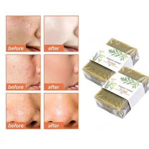 สบู่สมุนไพรไวท์เทนนิ่งสูตรเฉพาะสำหรับแบรนด์ส่วนตัว ลดเลือนจุดด่างดำ สบู่โคจิกแอซิด ช่วยปรับผิวหมองคล้ำให้กระจ่างใส รับผลิตแบบ OEM ODM - Product Image 4