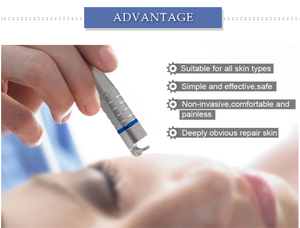 Dispositivo Portátil de 40W para Eliminación de <span class=keywords><strong>Arañas</strong></span> <span class=keywords><strong>Vasculares</strong></span> y Varices, Tecnología de 980nm, Cepillo Facial, Máquina de Belleza - Product Image 2