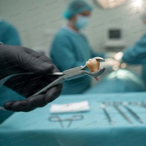 Pince de fermeture pour anneaux de piercing corporel, en acier inoxydable allemand standard, manuelle, pour usage chirurgical ORL, certifiée CE, Vaslcare - Product Image 5