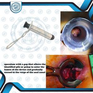 Nouveau spéculum professionnel de gynécologie de proctoscope de Fansler avec des Instruments chirurgicaux d'obturateur en caoutchouc dur PAR DADDY D PRO CE ISO - Product Image 6