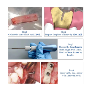 Kit d'implantation chirurgicale GBR pour réparation osseuse avec micro-vis, bloc osseux, poignée de guidage pour perceuse pilote et guide de reconstruction osseuse SLT - Product Image 6
