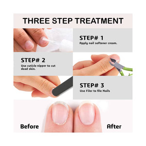 Coupe-cuticules professionnel avec lames aiguisées en acier inoxydable pour le soin et l'entretien des ongles - Product Image 5