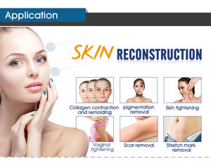 ADSS CO2-Laser Schönheitsgerät zur Vaginalen Straffung Laser-Hautregeneration CO2-Fraktional-Lasergerät - Product Image 5