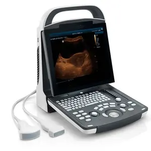 Machine à ultrasons portable humaine Mindray DP-10 système de diagnostic par ultrasons Mindray