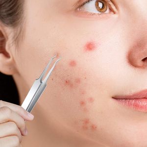 3PCS Stainless Steel <b>Blackhead</b> Tweezers Pimple <b>Extractor</b> <b>Tool</b> Curved Bend Tweezers for Remove Zit Whitehead Skin Care - Product Image 6