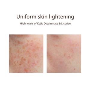 Crema Blanqueadora con Dipalmitato de Kójico y Escualano para la Corrección de la Hiperpigmentación, Antienvejecimiento, Humectante para Piel Oscura, Sin Fragancia - Product Image 3