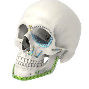 Ensemble d'instruments de chirurgie maxillo-faciale personnalisables et réutilisables en acier inoxydable, manuels, pour usage hospitalier, chirurgie abdominale - Product Image 3