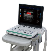 Escáner Ultrasónico para Embarazo a Precio de Fábrica, Máquina de Ultrasonido Fácil de Transportar, Portátil y Ligera para Hospital y Veterinaria