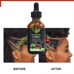 Aceite Capilar Orgánico 3 en 1 en Oferta, Aceite de Batana, Ricino y Romero, Anticaída del Cabello, Acondicionamiento Profundo, Crecimiento Natural, Nutrición para Hombres - Product Image 2