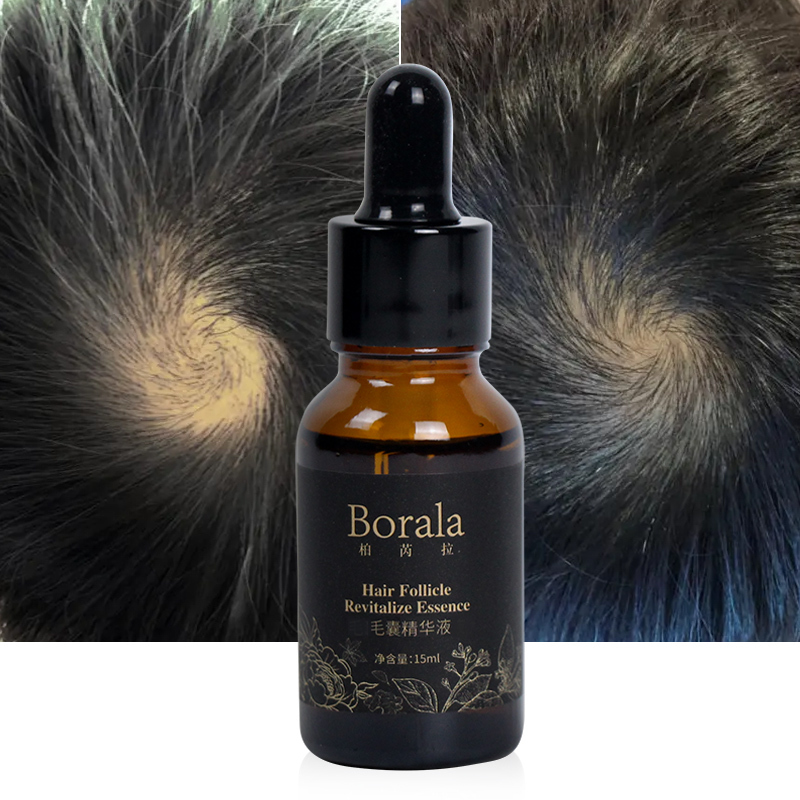 Hair Growth Treatment Herbal Organic Scalp