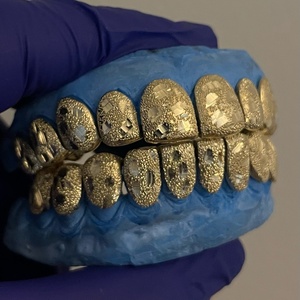 AMBER JEWELS Grillz dentaire en argent 925 avec strass en cristal taille brillant, style Hiphop de luxe, unisexe, pour usage quotidien, cadeau - Product Image 1