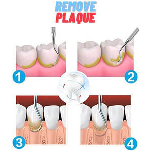 Kit d'examen dentaire de base 3 pièces réutilisable, instruments dentaires manuels en acier inoxydable de qualité allemande, diagnostic par Grip Surgical - Product Image 2