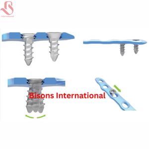 ชุดเครื่องมือผ่าตัดกระดูกข้อเท้าและเท้าแบบไทเทเนียมสำหรับขายส่ง สำหรับการผ่าตัดกระดูกและข้อและศัลยกรรมกระดูกหัก - Product Image 4