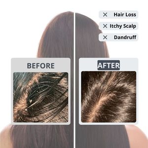 ERIGERON Vegan <b>Shampoo</b> Ball All in One <b>Black</b> Charcoal <b>Hair</b> Treatment - Product Image 2