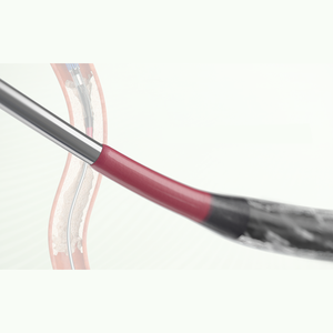 Implant coronaire avancé TER Ultimaster Tansei pour les spécialistes professionnels en cardiologie - Product Image 5