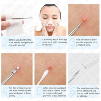 Ensemble d'outils de soin du visage en acier inoxydable 5 pièces – Extracteur de points noirs, d'imperfections et de comédons avec étui en cuir