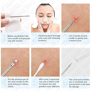 Ensemble d'outils de soin du visage en acier inoxydable 5 pièces – Extracteur de points noirs, d'imperfections et de comédons avec étui en cuir - Product Image 5