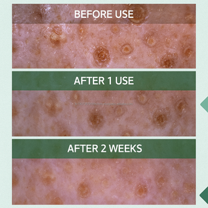 Pack nettoyant moussant au charbon de thé vert doux K Beauty, nettoyage en profondeur pour une texture lactée parfumée, tous types de peau, estampillage doré - Product Image 6